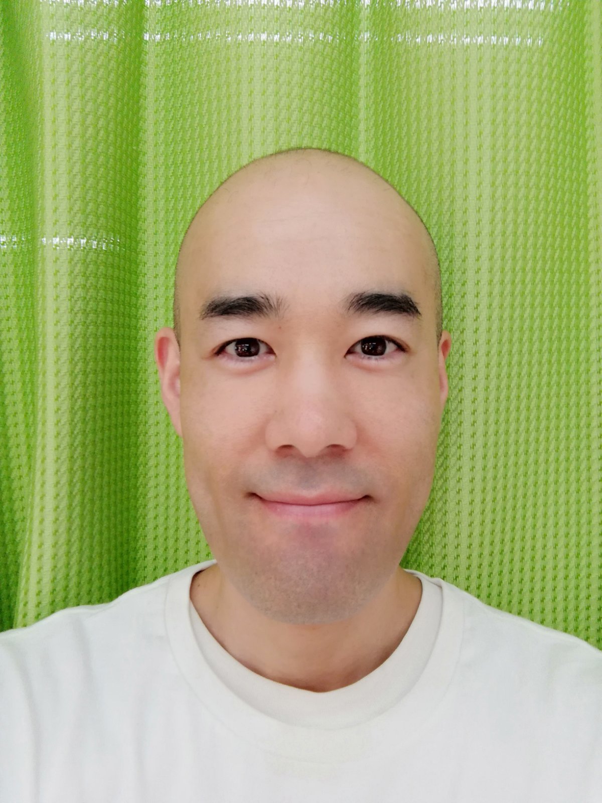 筋弛緩術の施術